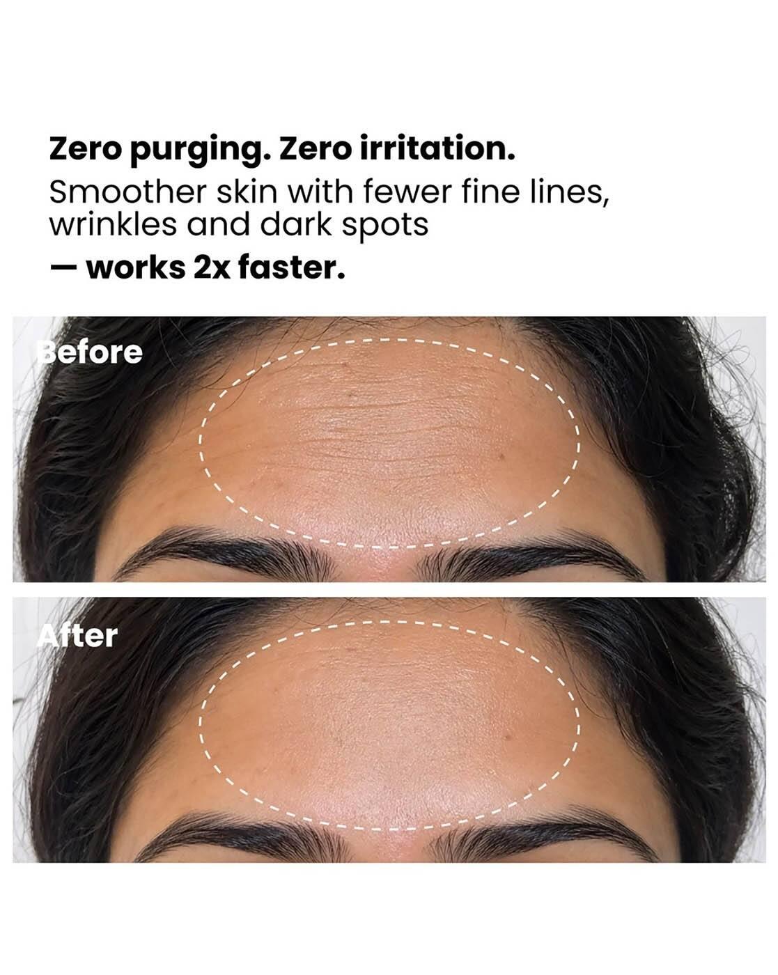 0.15 Encapsulated Retinol Night Serum